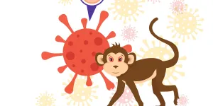 Tout savoir sur le virus Mpox (variole du singe) : la chronique du Dr Gérald Kierzek