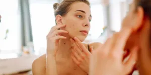 Soins du visage : nos conseils pour éviter les boutons et l'acné