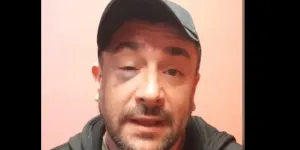 "Cinq heures d'urgence, trois heures de commissariat" : L'humoriste Anthony Joubert victime d'une violente agression