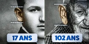 Pourquoi les oreilles s'allongent avec l'âge ?