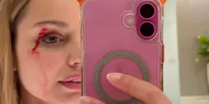 “Je comprends pourquoi les gens ont peur des oiseaux !” : une journaliste est blessée au visage par une mouette en direct !