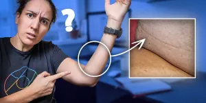 Personne ne parle de cette ligne sur l’avant-bras (et c’est bizarre)