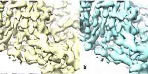 Les carences de la cryo-microscopie illustrent l’absence de stratégie de la recherche française