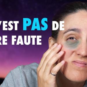 Les cernes ne sont pas un signe de fatigue