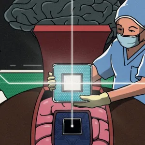Comment les implants cérébraux volent au secours de la psychiatrie