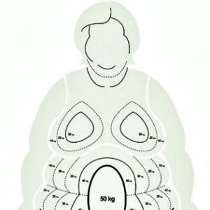 Fatphobia is a Queer and Feminist Issue