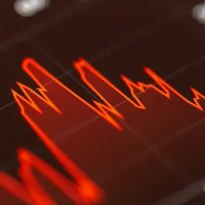 La bulle de l’IA et l’économie étatsunienne - Contretemps