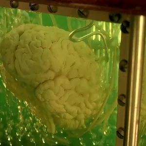 Voici le tout premier ordinateur biologique fabriqué à partir de neurones humains