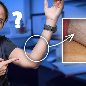 Personne ne parle de cette ligne sur l’avant-bras (et c’est bizarre)