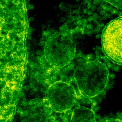 Coronavirus : un antigène développé avec une IA, le vaccin est testé chez l’humain