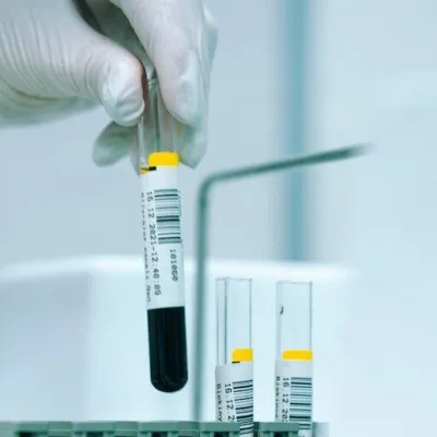 The Test