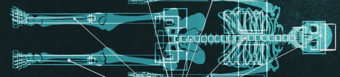 Les AI Overviews de Google fournissent aussi des conseils de santé erronés